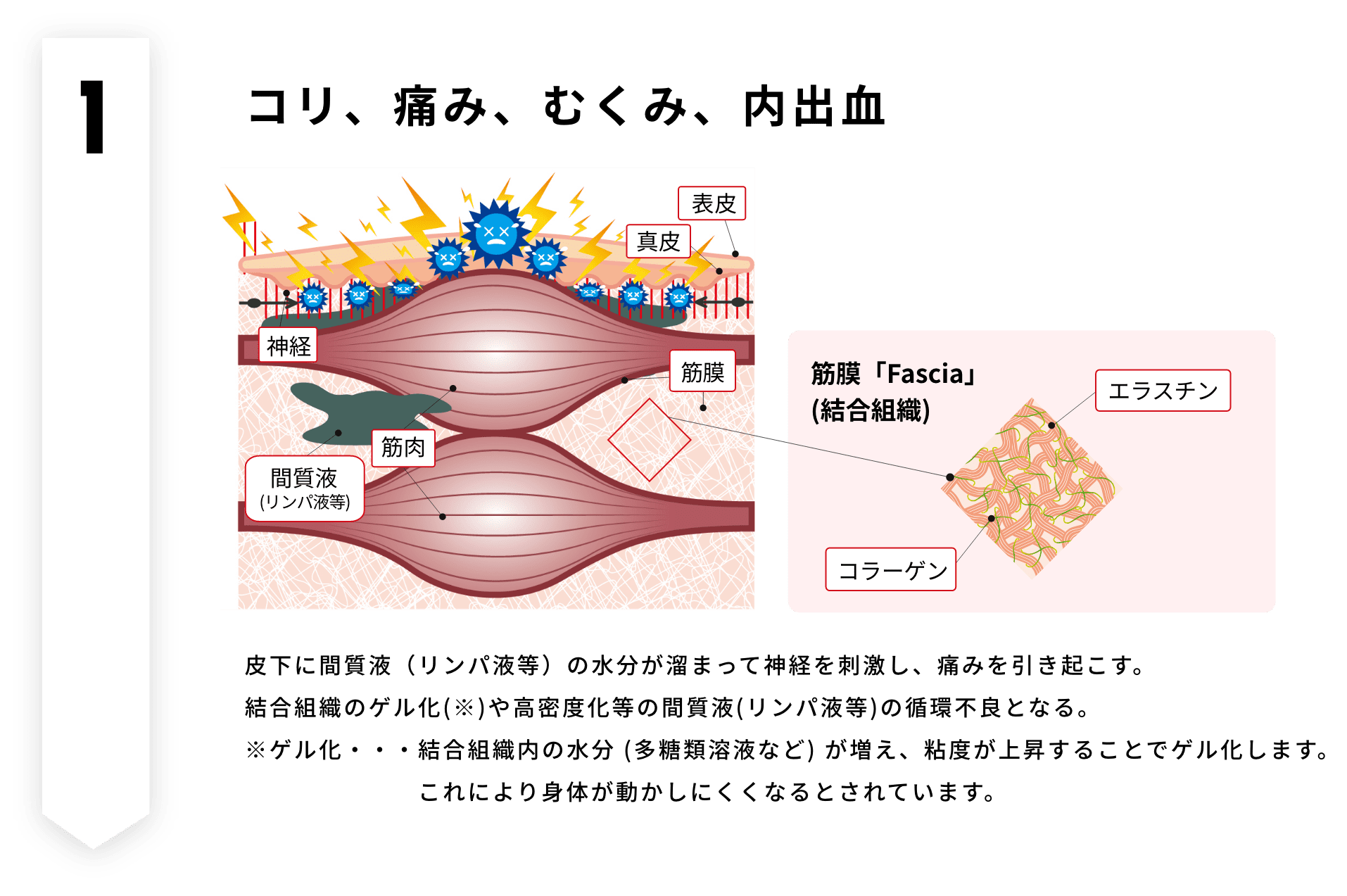 コリ、痛み、むくみ、内出血