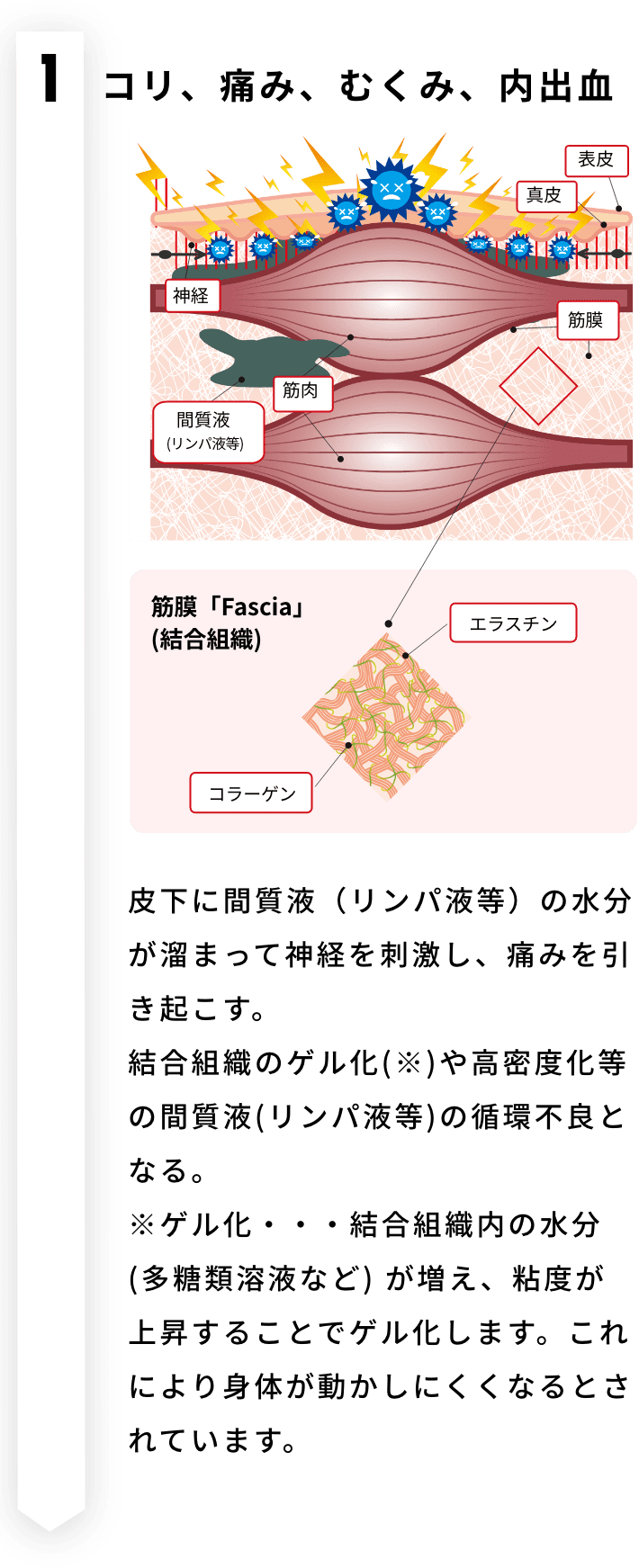 コリ、痛み、むくみ、内出血